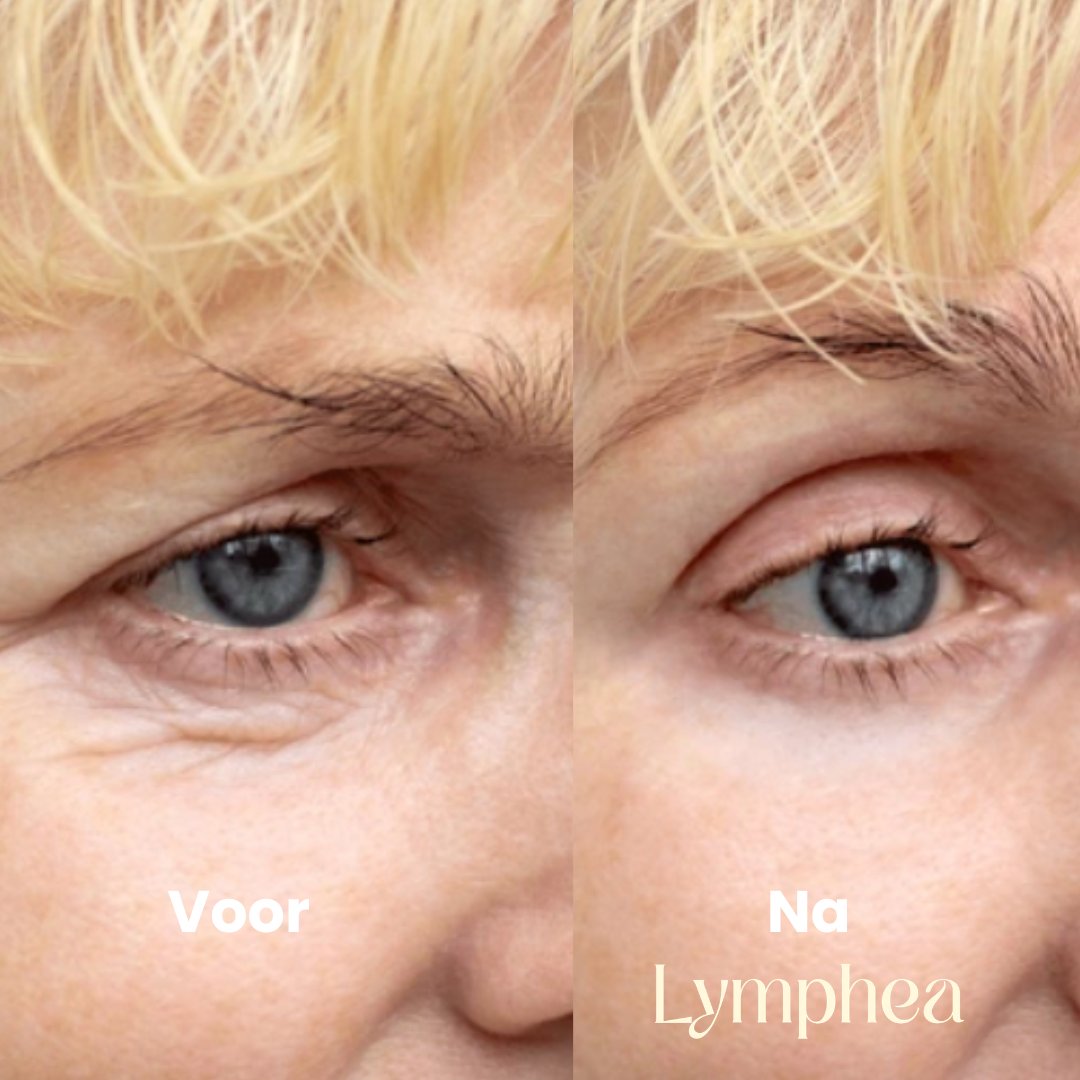 Lymphea Brostel